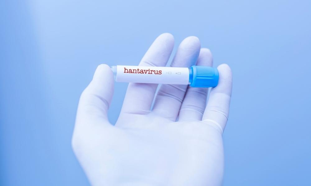 Sağlık Bakanlığı’ndan hantavirüs açıklaması: 
